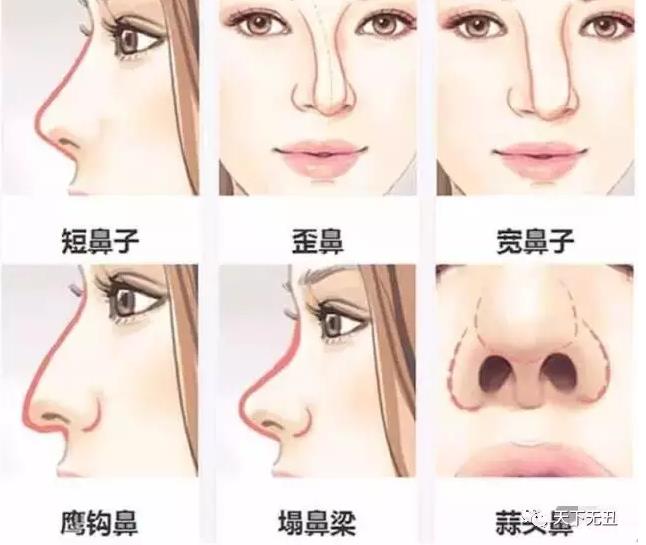 北京鼻整形